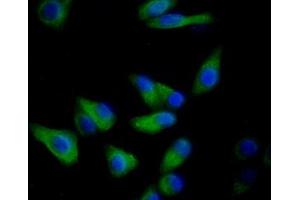 Immunohistochemistry (IHC) image for anti-Keratin 19 (KRT19) (AA 245-391) antibody (ABIN7427978)