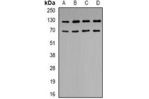 Western blot analysis of K Cadherin expression in BT474 (A), A549 (B), SHSY5Y (C), HEK293T (D) whole cell lysates. (CDH6 抗体)