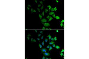 Immunofluorescence analysis of U2OS cells using PSG1 antibody (ABIN6293474). (PSG1 抗体)