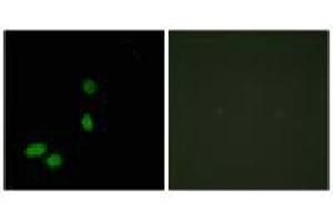 Immunofluorescence analysis of HeLa cells, using HMG17 antibody. (HMGN2 抗体)