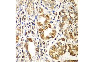 Immunohistochemistry of paraffin-embedded human gastric using RAC1 antibody. (RAC1 抗体  (AA 1-192))