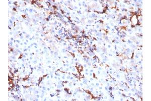 Immunohistochemistry (IHC) image for anti-Cathepsin K (CTSK) (AA 163-274) antibody (ABIN6939219)