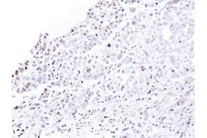 Immunohistochemistry (IHC) image for anti-Nucleoporin 62kDa (NUP62) antibody (ABIN2856548)