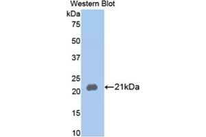 WB of Protein Standard: different control antibodies against Highly purified E. (MMP13 ELISA 试剂盒)