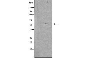 Western blot analysis of extracts from COLO cells, using UGDH antibody. (UGDH 抗体  (C-Term))