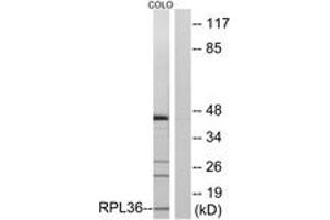 Western blot analysis of extracts from COLO cells, using RPL36 Antibody. (RPL36 抗体  (AA 51-100))