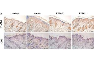 EPD inhibited inflammatory cell infiltration in IMQ-induced psoriasis-like mouse mode. (ICAM1 抗体  (AA 201-300))