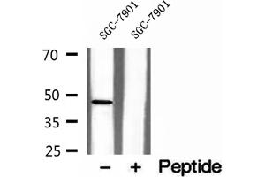 Western blot analysis of extracts of SGC-7901 cells, using NOB1 antibody. (NOB1 抗体  (C-Term))