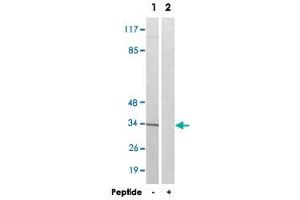 Western blot analysis of extracts from Jurkat cells, using AQP12A polyclonal antibody . (Aquaporin 12A 抗体)