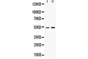Western blot analysis of SERPINA1 expression in rat brain extract ( Lane 1) and HELA whole cell lysates ( Lane 2). (SERPINA1 抗体  (AA 25-204))