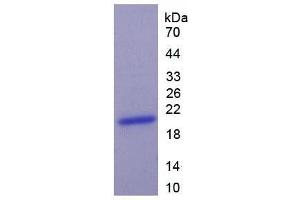 SDS-PAGE (SDS) image for Keratin 9 (KRT9) ELISA Kit (ABIN6720501)
