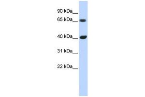 WB Suggested Anti-CCND1 Antibody Titration:  0. (Cyclin D1 抗体  (N-Term))