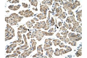NEU1 antibody was used for immunohistochemistry at a concentration of 4-8 ug/ml to stain Skeletal muscle cells (arrows) in Human Muscle. (NEU1 抗体)
