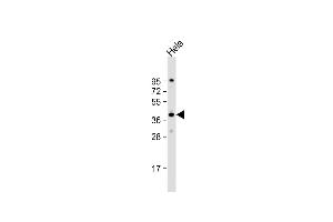 anti-DnaJ (Hsp40) Homolog, Subfamily B, Member 4 (DNAJB4) (AA 216-248) antibody