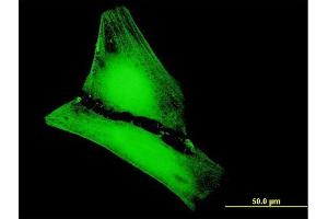 Immunofluorescence of purified MaxPab antibody to MGC50559 on HeLa cell. (METTL20 抗体  (AA 1-262))