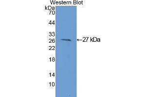 Western Blotting (WB) image for anti-Glutathione S-Transferase mu 1 (GSTM1) (AA 1-218) antibody (ABIN1078084) (GSTM1 抗体  (AA 1-218))