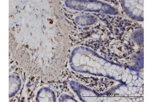 Immunoperoxidase of monoclonal antibody to ACTRT2 on formalin-fixed paraffin-embedded human colon. (ACTRT2 抗体  (AA 209-299))
