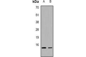 Western blot analysis of FABP2 expression in K562 (A), mouse lung (B) whole cell lysates. (FABP2 抗体  (C-Term))