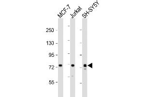 All lanes : Anti-KIF22 Antibody (Center) at 1:2000 dilution Lane 1: MCF-7 whole cell lysates Lane 2: Jurkat whole cell lysates Lane 3: SH-SY5Y whole cell lysates Lysates/proteins at 20 μg per lane. (KIF22 抗体  (AA 423-456))