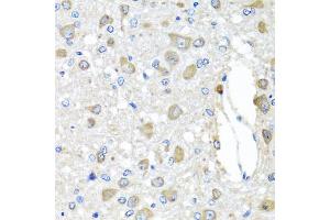 Immunohistochemistry of paraffin-embedded rat brain using BAG5 antibody (ABIN5975259) at dilution of 1/100 (40x lens). (BAG5 抗体)