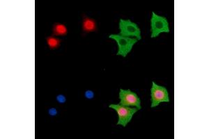 ABIN7096643 and ABIN7100708 staining HepG2 cells by IF/ICC. (Forkhead Box J2 抗体)
