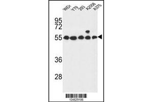 Western blot analysis in WiDr,Y79,293,A2058,A375 cell line lysates (35ug/lane). (GPR180 抗体  (AA 119-147))