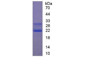 Image no. 1 for Cold Inducible RNA Binding Protein (CIRBP) (AA 1-172) (Active) protein (His tag) (ABIN6239789) (CIRBP Protein (AA 1-172) (His tag))