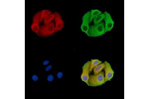 C20orf27 Antibody staining Hela cells by IF/ICC. (C20ORF27 抗体)