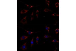 Immunofluorescence (IF) image for anti-Ribosomal Protein L26 (RPL26) (AA 20-95) antibody (ABIN7269999)