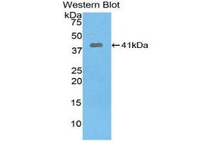 Western blot analysis of the recombinant protein. (PYGO1 抗体  (AA 201-419))
