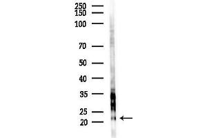 anti-Tumor Necrosis Factor, alpha-Induced Protein 8 (TNFAIP8) (Internal Region) antibody