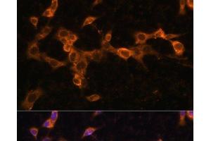 Immunofluorescence analysis of NIH/3T3 cells using PDGFR beta Polyclonal Antibody at dilution of 1:100. (PDGFRB 抗体)