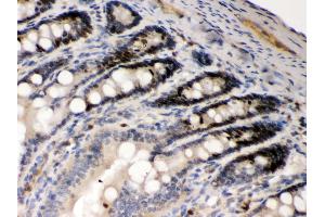 Anti- AIM2 Picoband antibody, IHC(P) IHC(P): Rat Intestine Tissue