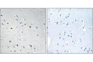 Immunohistochemistry analysis of paraffin-embedded human brain tissue, using CDC25C (Ab-48) Antibody. (CDC25C 抗体  (AA 14-63))