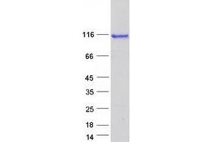Western Blotting (WB) image for DIS3-Like Exonuclease 2 (DIS3L2) protein (Myc-DYKDDDDK Tag) (ABIN2719501)