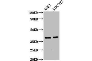 Western Blot Positive WB detected in: K562 whole cell lysate, NIH/3T3 whole cell lysate All lanes: ZNF367 antibody at 6 μg/mL Secondary Goat polyclonal to rabbit IgG at 1/50000 dilution Predicted band size: 39, 33 kDa Observed band size: 39 kDa (ZNF367 抗体  (AA 83-151))
