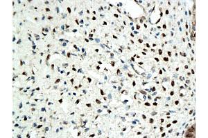 Formalin-fixed and paraffin embedded rat ovary tissue labeled with Anti-ER beta Polyclonal Antibody, Unconjugated (ABIN725210), followed by conjugation to the secondary antibody and DAB staining (ESR2 抗体  (AA 201-300))