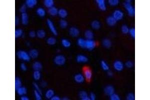 Immunofluorescence analysis of Human stomach tissue using Epsilon Tubulin Monoclonal Antibody at dilution of 1:200. (TUBE1 抗体)