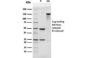 SDS-PAGE Analysis Purified ACTN4 Mouse Monoclonal Antibody (93).