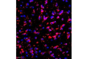 Immunofluorescence of paraffin embedded mouse brain using eIF5A2 (ABIN7073893) at dilution of 1:300 (400x lens) (EIF5A2 抗体)