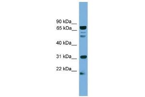 Western Blotting (WB) image for anti-Solute Carrier Family 6 (Neurotransmitter Transporter, Dopamine), Member 3 (SLC6A3) (N-Term) antibody (ABIN928031)