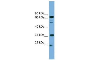 SLC6A3 antibody used at 0. (SLC6A3 抗体  (N-Term))