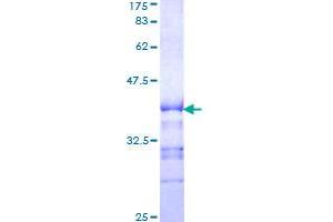 KSR1 Protein (AA 301-400) (GST tag)