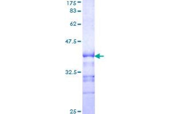 KSR1 Protein (AA 301-400) (GST tag)