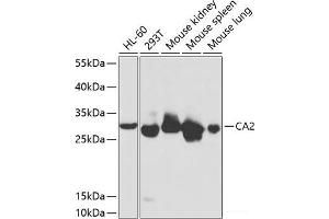 Western blot analysis of extracts of various cell lines using CA2 Polyclonal Antibody at dilution of 1:1000. (CA2 抗体)