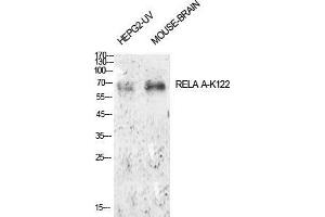 Western Blot (WB) analysis of HepG2-UV, Mouse Brain cells using Acetyl-NFkappaB-p65 (K122) Polyclonal Antibody. (NF-kB p65 抗体  (acLys122))