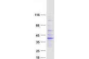 Validation with Western Blot (RIMS3 Protein (Myc-DYKDDDDK Tag))