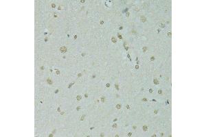 Immunohistochemistry (Paraffin-embedded Sections) (IHC (p)) image for anti-Scaffold Attachment Factor B (SAFB) (AA 1-200) antibody (ABIN6147357)