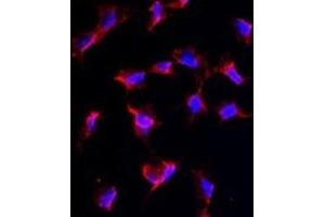 Immunofluorescence (IF) image for anti-Nanos Homolog 1 (NANOS1) antibody (ABIN2997721) (Nanos Homolog 1 抗体)
