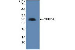 Detection of Recombinant cPLA2, Human using Polyclonal Antibody to Cytosolic Phospholipase A2 (PLA2G4) (PLA2G4A 抗体  (AA 1-178))